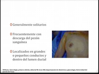 0 Generalmente solitarios
0 Frecuentemente con
descarga del pezón
sanguínea
0 Localizados en grandes
o pequeños conductos y
dentro del lumen ductal
Williams, Ginecología, primera edición, editorial Mc Graw Hill, departamento de obstetricia y ginecología, Universidad del
sureste de Texas
 