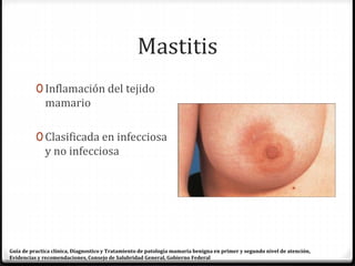 Mastitis
0 Inflamación del tejido
mamario
0 Clasificada en infecciosa
y no infecciosa
Guía de practica clínica, Diagnostico y Tratamiento de patología mamaria benigna en primer y segundo nivel de atención,
Evidencias y recomendaciones, Consejo de Salubridad General, Gobierno Federal
 