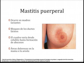 Mastitis puerperal
0 Ocurre en madres
lactantes
0 Bloqueo de los ductos
lácteos
0 El cuadro varia desde
celulitis hasta formación
de abscesos
0 Áreas dolorosas en la
mama o la areola
Guía de practica clínica, Diagnostico y Tratamiento de patología mamaria benigna en primer y segundo nivel de atención,
Evidencias y recomendaciones, Consejo de Salubridad General, Gobierno Federal
 