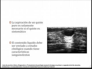 0 La aspiración de un quiste
puro es solamente
necesario si el quiste es
sintomático
0 El contenido liquido debe
ser enviado a estudio
citológico cuando tiene
características
sanguinolentas
Guía de practica clínica, Diagnostico y Tratamiento de patología mamaria benigna en primer y segundo nivel de atención,
Evidencias y recomendaciones, Consejo de Salubridad General, Gobierno Federal
 