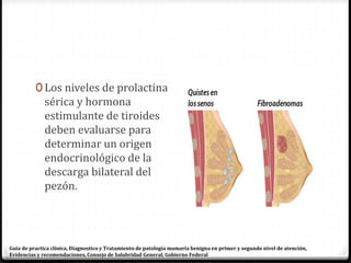 0 Los niveles de prolactina
sérica y hormona
estimulante de tiroides
deben evaluarse para
determinar un origen
endocrinológico de la
descarga bilateral del
pezón.
Guía de practica clínica, Diagnostico y Tratamiento de patología mamaria benigna en primer y segundo nivel de atención,
Evidencias y recomendaciones, Consejo de Salubridad General, Gobierno Federal
 