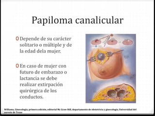 Papiloma canalicular
0 Depende de su carácter
solitario o múltiple y de
la edad dela mujer.
0 En caso de mujer con
futuro de embarazo o
lactancia se debe
realizar extirpación
quirúrgica de los
conductos.
Williams, Ginecología, primera edición, editorial Mc Graw Hill, departamento de obstetricia y ginecología, Universidad del
sureste de Texas
 