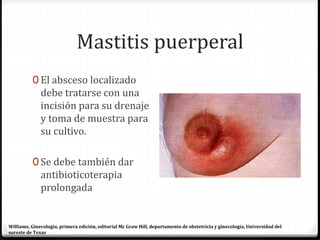 Mastitis puerperal
0 El absceso localizado
debe tratarse con una
incisión para su drenaje
y toma de muestra para
su cultivo.
0 Se debe también dar
antibioticoterapia
prolongada
Williams, Ginecología, primera edición, editorial Mc Graw Hill, departamento de obstetricia y ginecología, Universidad del
sureste de Texas
 