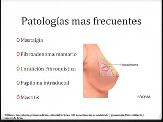 Patologías mas frecuentes
0 Mastalgia
0 Fibroadenoma mamario
0 Condición Fibroquistica
0 Papiloma intraductal
0 Mastitis
Williams, Ginecología, primera edición, editorial Mc Graw Hill, departamento de obstetricia y ginecología, Universidad del
sureste de Texas
 