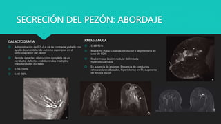 SECRECIÓN DEL PEZÓN: ABORDAJE
GALACTOGRAFÍA
 Administración de 0.2 -0.4 ml de contraste yodado con
ayuda de un catéter de extremo esponjoso en el
orificio secretor del pezón
 Permite detectar: obstrucción completa de un
conducto, defectos endoluminales múltiples,
irregularidades ductales
 S: 56-100%
 E: 41-98%
RM MAMARIA
 S: 88-95%
 Realce no masa: Localización ductal o segmentaria en
caso de CDIS
 Realce masa: Lesión nodular delimitada
hipervascularizada
 En ausencia de lesiones: Presencia de conductos
retroareolares dilatados, hiperintenso en T1, sugerente
de ectasia ductal
 