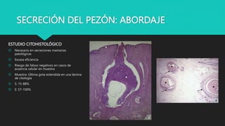 SECRECIÓN DEL PEZÓN: ABORDAJE
ESTUDIO CITOHISTOLÓGICO
 Necesario en secreciones mamarias
patológicas
 Escasa eficiencia
 Riesgo de falsos negativos en casos de
ausencia celular en muestra
 Muestra: Última gota extendida en una lámina
de citología
 S: 15-88%
 E: 57-100%
 