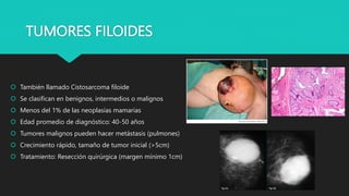 TUMORES FILOIDES
 También llamado Cistosarcoma filoide
 Se clasifican en benignos, intermedios o malignos
 Menos del 1% de las neoplasias mamarias
 Edad promedio de diagnóstico: 40-50 años
 Tumores malignos pueden hacer metástasis (pulmones)
 Crecimiento rápido, tamaño de tumor inicial (>5cm)
 Tratamiento: Resección quirúrgica (margen mínimo 1cm)
 