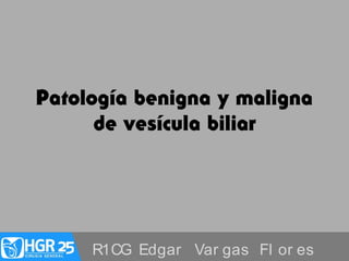 Patología benigna y maligna
de vesícula biliar
R1CG Edgar Var gas Fl or es
 