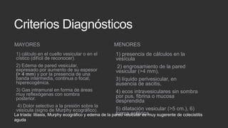 Criterios Diagnósticos
MAYORES

MENORES

1) presencia de cálculos en la
vesícula
2) Edema de pared vesicular,
2) engrosamiento de la pared
expresado por aumento de su espesor
vesicular (>4 mm),
(> 4 mm) y por la presencia de una
banda intermedia, continua o focal,
3) líquido perivesicular, en
hiperecogénica.
ausencia de ascitis,
3) Gas intramural en forma de áreas
4) ecos intravesiculares sin sombra
muy reflexógenas con sombra
por pus, fibrina o mucosa
posterior.
desprendida
4) Dolor selectivo a la presión sobre la
5) dilatación vesicular (>5 cm.), 6)
vesícula (signo de Murphy ecográfico).
forma esférica
La tríada: litiasis, Murphy ecográfico y edema de la pared vesicular es muy sugerente de colecistitis
1) cálculo en el cuello vesicular o en el
cístico (difícil de reconocer).

aguda

 