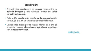 PAPILOMA
DESCRIPCIÓN
▪ Crecimientos papilares y verrucosos compuestos de
epitelio benigno y una cantidad menor de tejido
conectivo de apoyo.
▪ Es la lesión papilar más común de la mucosa bucal y
constituye el 2.5% de todas las lesiones de la boca.
▪ Las lesiones miden por lo regular menos de 1 cm. Se
presentan como alteraciones granulares exofíticas
con aspecto de coliflor.
 