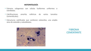 FIBROMA
CEMENTANTE
HISTOPATOLOGÍA
▪ Estroma colagenoso con células fusiformes uniformes o
estrelladas.
▪ Calcificaciones amorfas esféricas de varios tamaños
(cementículos).
▪ Estructuras calcificadas que contienen osteocitos, una amplia
zona de osteoide y osteoblastos.
 