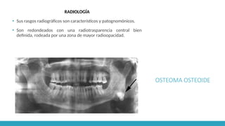 OSTEOMA OSTEOIDE
RADIOLOGÍA
▪ Sus rasgos radiográficos son característicos y patognomónicos.
▪ Son redondeados con una radiotrasparencia central bien
definida, rodeada por una zona de mayor radioopacidad.
 