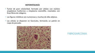 FIBROSARCOMA
HISTOPATOLOGÍA
▪ Tumor de gran celularidad, formado por células con núcleos
anaplásicos fusiformes y citoplasma eosinófilo, mezclados con
finas fibras de colágeno.
▪ Las figuras mitóticas son numerosas y muchas de ellas atípicas.
▪ Las células se disponen en fascículos, formandu un patrón en
raspa de pescado.
 