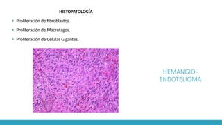HEMANGIO-
ENDOTELIOMA
HISTOPATOLOGÍA
▪ Proliferación de fibroblastos.
▪ Proliferación de Macrófagos.
▪ Proliferación de Células Gigantes.
 