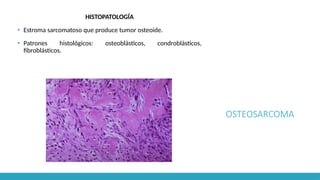 OSTEOSARCOMA
HISTOPATOLOGÍA
▪ Estroma sarcomatoso que produce tumor osteoide.
▪ Patrones histológicos: osteoblásticos, condroblásticos,
fibroblásticos.
 