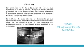 TUMOR
METASTÁSICO DE LOS
MAXILARES
DESCRIPCIÓN
▪ Los carcinomas son los tipos de cáncer más comunes que
metastizan a la boca y maxilas. Aunque los tejidos blandos
pueden ser afectados, la metástasis hacia los huesos, en especial
la mandíbula posterior son considerablemente más normales.
Puede ser multifocal en estos tejidos.
▪ La incidencia de estos cánceres es desconocida ya que
normalmente es una manifestación de enfermedades avanzadas.
Viene con un pronóstico grave, ya que representa una
enfermedad avanzada y los pacientes mueren alrededor de un
año después.
 