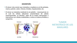 TUMOR
METASTÁSICO DE LOS
MAXILARES
DESCRIPCIÓN
▪ El cáncer más común que metastiza a maxilares es el de próstata,
mama, pulmón, colon, riñones, tiroides, hepatocelular, etc.
▪ El cáncer se metastiza mediante la vía epitelio – mesenquimal, en
el cual las células adquieren características de células
mesenquimales, se desatan, salen de la matriz extracelular e
interactúan con células endoteliales y entran al sistema linfático y
sanguíneo.
 