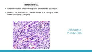 ADENOMA
PLEOMORFO
HISTOPATOLOGÍA
▪ Transformación de epitelio metaplásico en elementos escamosos.
▪ Presencia de una marcada cápsula fibrosa, que distingue entre
procesos malignos y benignos.
 