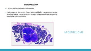 MIOEPITELIOMA
HISTOPATOLOGÍA
▪ Células plasmacitoides o fusiformes.
▪ Poco estroma de fondo, hasta anormalidades con concentración
significativa de elementos mucoides o mixoides dispuestos entre
las células mioepiteliales.
 