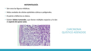 CARCINOMA
QUÍSTICO ADENOIDE
HISTOPATOLOGÍA
▪ Son raras las figuras mitóticas.
▪ Nidos ovalados de células epiteliales cúbicas o poligonales.
▪ El patrón cribiforme es clásico.
▪ Existen islotes tumorales, que tienen múltiples espacios y le dan
el aspecto de queso suizo.
 