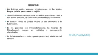 HISTOPLASMOSIS
DESCRIPCIÓN
▪ Las lesiones orales aparecen principalmente en las encías,
lengua, paladar y mucosa de la mejilla.
▪ Tienen inicialmente el aspecto de un nódulo y una úlcera crónica
con bordes elevados, así como induración del tejido circundante.
▪ El aspecto clínico se parece mucho al del carcinoma o la
tuberculosis.
▪ En los pacientes con inmunodeficiencias las lesiones de
histoplasmosis pueden ser múltiples y extensamente
diseminadas.
▪ La linfadenopatía es común y puede presentarse afectación del
cerebro.
 