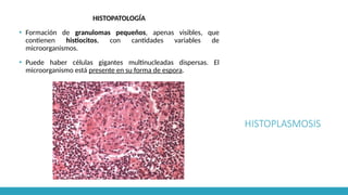 HISTOPLASMOSIS
HISTOPATOLOGÍA
▪ Formación de granulomas pequeños, apenas visibles, que
contienen histiocitos, con cantidades variables de
microorganismos.
▪ Puede haber células gigantes multinucleadas dispersas. El
microorganismo está presente en su forma de espora.
 