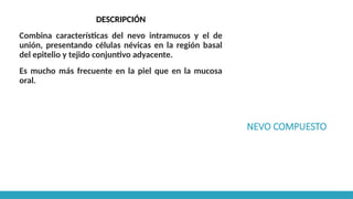 NEVO COMPUESTO
DESCRIPCIÓN
Combina características del nevo intramucos y el de
unión, presentando células névicas en la región basal
del epitelio y tejido conjuntivo adyacente.
Es mucho más frecuente en la piel que en la mucosa
oral.
 