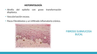 FIBROSIS SUBMUCOSA
BUCAL
HISTOPATOLOGÍA
▪ Atrofia del epitelio con grave transformación
displásica.
▪ Vascularización escasa.
▪ Pocos Fibroblastos y un infiltrado inflamatorio crónico.
 
