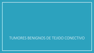 TUMORES BENIGNOS DE TEJIDO CONECTIVO
 