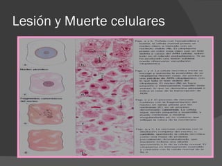 Lesión y Muerte celulares 