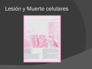 Lesión y Muerte celulares 
