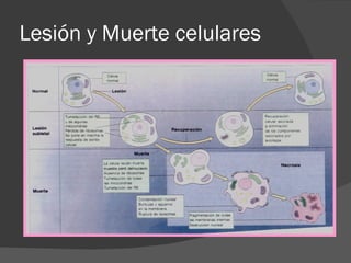 Lesión y Muerte celulares 