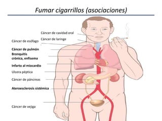 Fumar cigarrillos (asociaciones)
Cáncer de cavidad oral
Cáncer de laringe
Cáncer de esófago
Cáncer de pulmón
Bronquitis
crónica, enfisema
Infarto al miocardio
Ulcera péptica
Cáncer de páncreas
Ateroesclerosis sistémica
Cáncer de vejiga
 