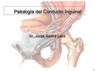 Patología del Conducto Inguinal

Dr. Jorge Godoy Lenz

 