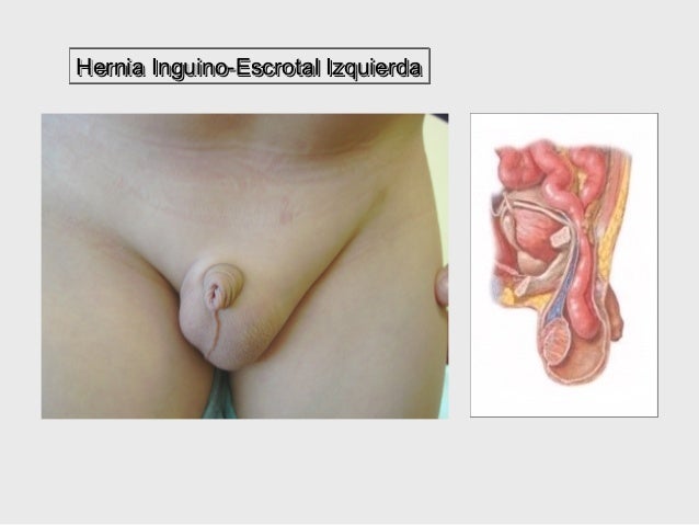 Se ha levantado por la mañana duele la espalda