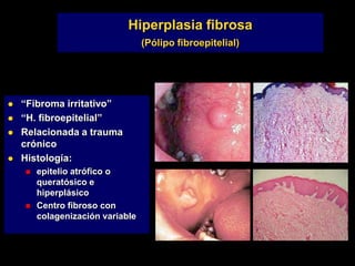 Hiperplasia fibrosa
(Pólipo fibroepitelial)
 “Fibroma irritativo”
 “H. fibroepitelial”
 Relacionada a trauma
crónico
 Histología:
 epitelio atrófico o
queratósico e
hiperplásico
 Centro fibroso con
colagenización variable
 