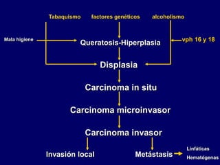 Tabaquismo factores genéticos alcoholismo
Queratosis-Hiperplasia
Displasia
Carcinoma in situ
Carcinoma microinvasor
Carcinoma invasor
Invasión local Metástasis
vph 16 y 18
Linfáticas
Hematógenas
Mala higiene
 