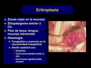 Eritroplasia
 Zonas rojas en la mucosa
 Etiopatogenia similar a
Ca.
 Piso de boca, lengua,
mucosa retromolar
 Histología:
 Congestión y aumento en la
vascularidad subepitelial
 Atrofia epitelial con:
 Displasia
 Carcinoma epidermoide in
situ
 Carcinoma epidermoide
invasor
 