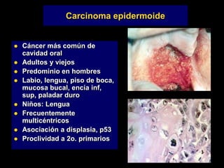 Carcinoma epidermoide
 Cáncer más común de
cavidad oral
 Adultos y viejos
 Predominio en hombres
 Labio, lengua, piso de boca,
mucosa bucal, encía inf,
sup, paladar duro
 Niños: Lengua
 Frecuentemente
multicéntricos
 Asociación a displasia, p53
 Proclividad a 2o. primarios
 