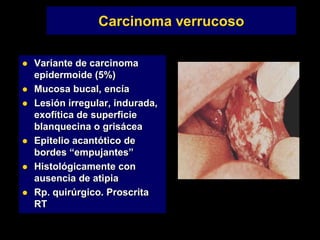 Carcinoma verrucoso
 Variante de carcinoma
epidermoide (5%)
 Mucosa bucal, encía
 Lesión irregular, indurada,
exofítica de superficie
blanquecina o grisácea
 Epitelio acantótico de
bordes “empujantes”
 Histológicamente con
ausencia de atipia
 Rp. quirúrgico. Proscrita
RT
 