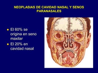 NEOPLASIAS DE CAVIDAD NASAL Y SENOS
PARANASALES
 El 60% se
origina en seno
maxilar
 El 20% en
cavidad nasal
60%
20%
 