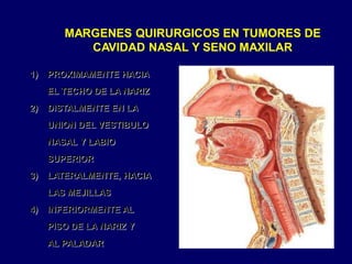 1) PROXIMAMENTE HACIA
EL TECHO DE LA NARIZ
2) DISTALMENTE EN LA
UNION DEL VESTIBULO
NASAL Y LABIO
SUPERIOR
3) LATERALMENTE, HACIA
LAS MEJILLAS
4) INFERIORMENTE AL
PISO DE LA NARIZ Y
AL PALADAR
MARGENES QUIRURGICOS EN TUMORES DE
CAVIDAD NASAL Y SENO MAXILAR
1
2
4
 