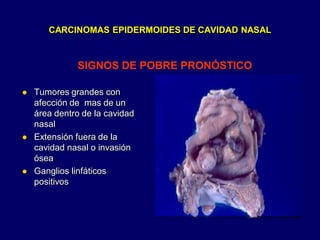 CARCINOMAS EPIDERMOIDES DE CAVIDAD NASAL
 Tumores grandes con
afección de mas de un
área dentro de la cavidad
nasal
 Extensión fuera de la
cavidad nasal o invasión
ósea
 Ganglios linfáticos
positivos
SIGNOS DE POBRE PRONÓSTICO
 