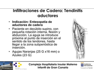 Infiltraciones de Cadera: Tendinitis aductores <ul><li>Indicación: Entesopatía de aductores de cadera </li></ul><ul><li>Pa...