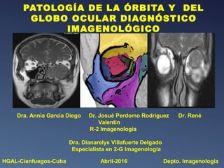 PATOLOGÍA DE LA ÓRBITA Y DEL
GLOBO OCULAR DIAGNÓSTICO
IMAGENOLÓGICO
Dra. Annia Garcia Diego Dr. Josué Perdomo Rodríguez Dr. René
Valentín
R-2 Imagenología
Dra. Dianarelys Villafuerte Delgado
Especialista en 2-G Imagenología
HGAL-Cienfuegos-Cuba Abril-2016 Depto. Imagenología
 