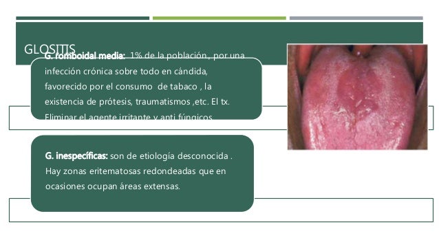 La tintura del propóleos ayuda al hongo de las uñas