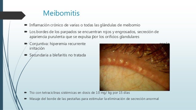 Patología De Los Parpados Patología De Los Parpados