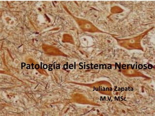 Patología del Sistema Nervioso
Juliana Zapata
M.V, MSc

 