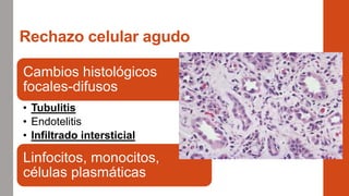 Rechazo celular agudo
Cambios histológicos
focales-difusos
• Tubulitis
• Endotelitis
• Infiltrado intersticial
Linfocitos, monocitos,
células plasmáticas
 