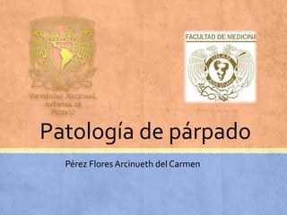 Patología de párpado 
Pérez Flores Arcinueth del Carmen 
 